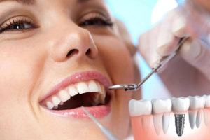 rechazo-de-implante-dental-sintomas-causas